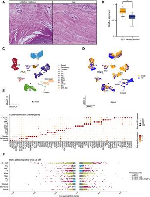 Transcriptional profiling sheds light on the fibrotic aspects of idiopathic subglottic tracheal stenosis
